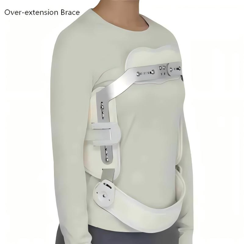 Adjustable Heat-Moldable Hyperextension Orthosis Over-Extension Fixator