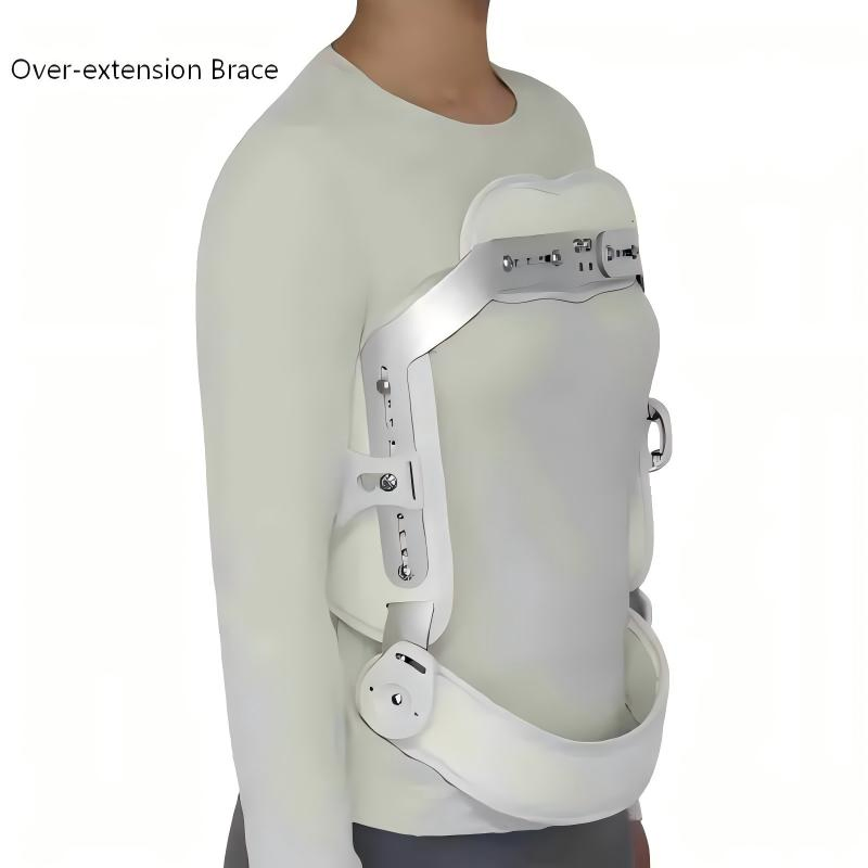 Adjustable Heat-Moldable Hyperextension Orthosis Over-Extension Fixator