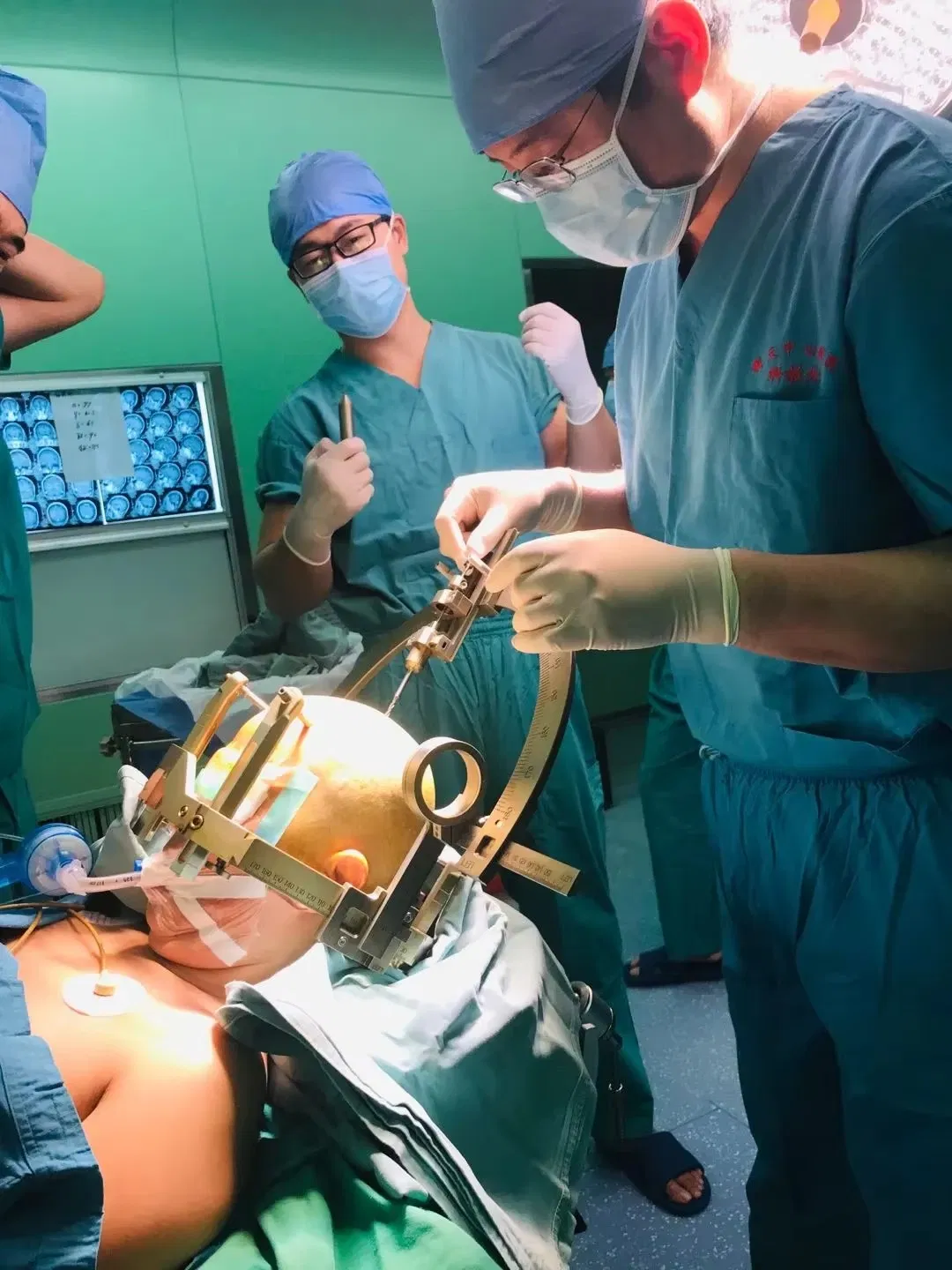 Sistema estereotáctico de marco de cabeza para estimulación cerebral profunda de alta precisión en neurocirugía