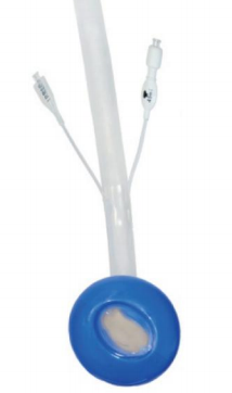 Sistema de Catéter Rectal con Dispositivo Innovador de Recolección de Manejo Fecal