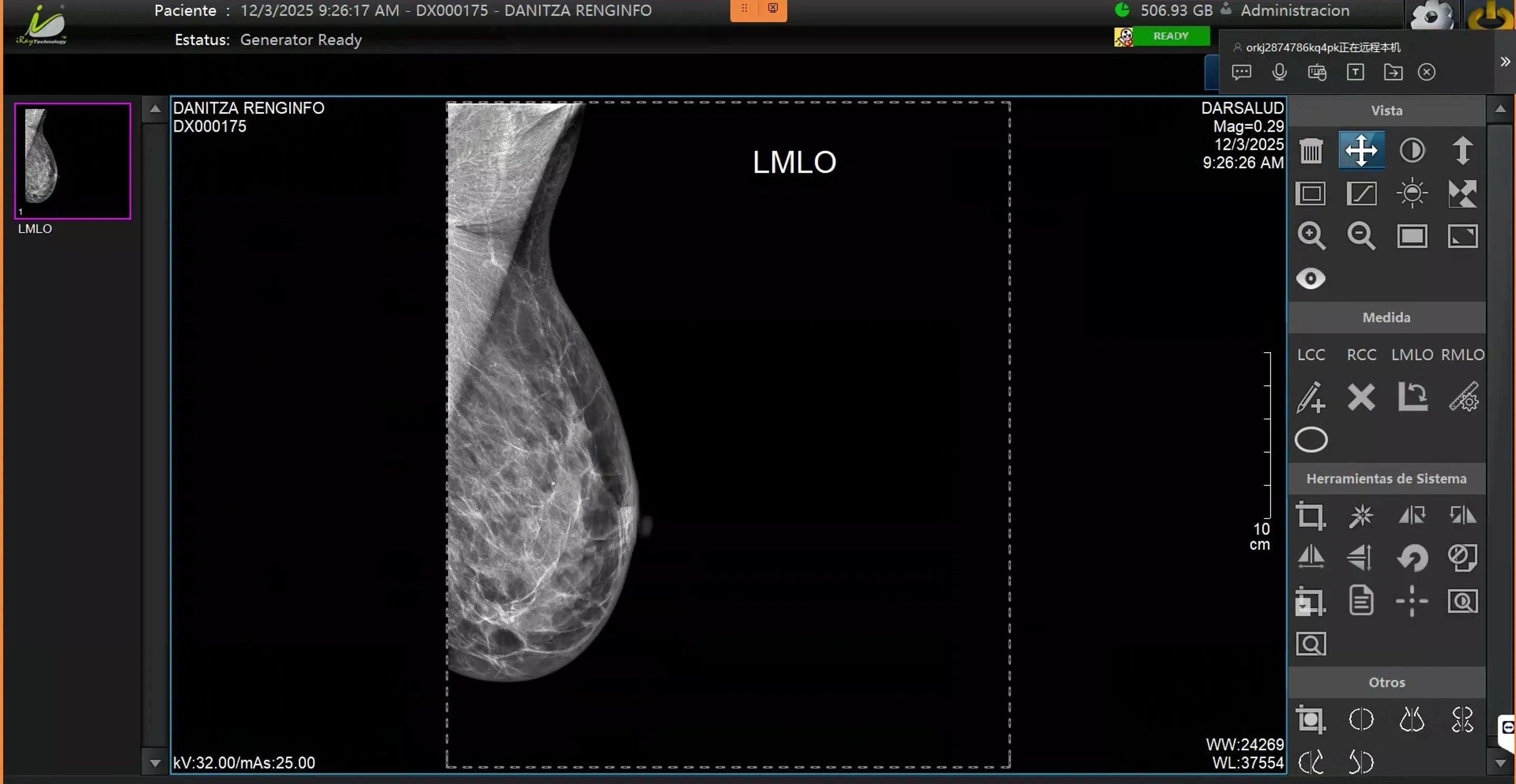 Imágenes de Cáncer de Mama Equipos Médico Máquina de Mamografía Digital