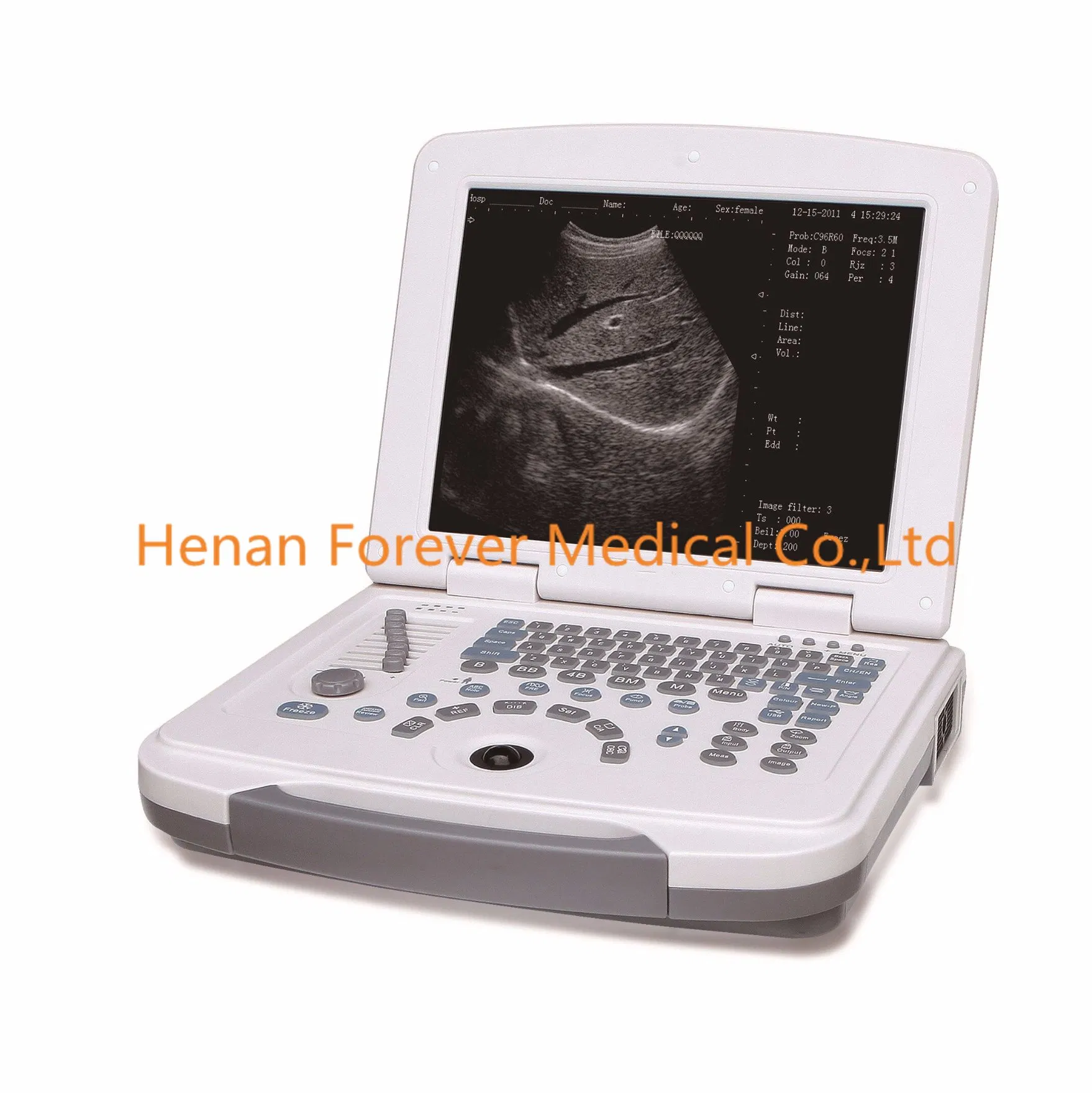 Sistema de rayos X C-Arm móvil con Fpd