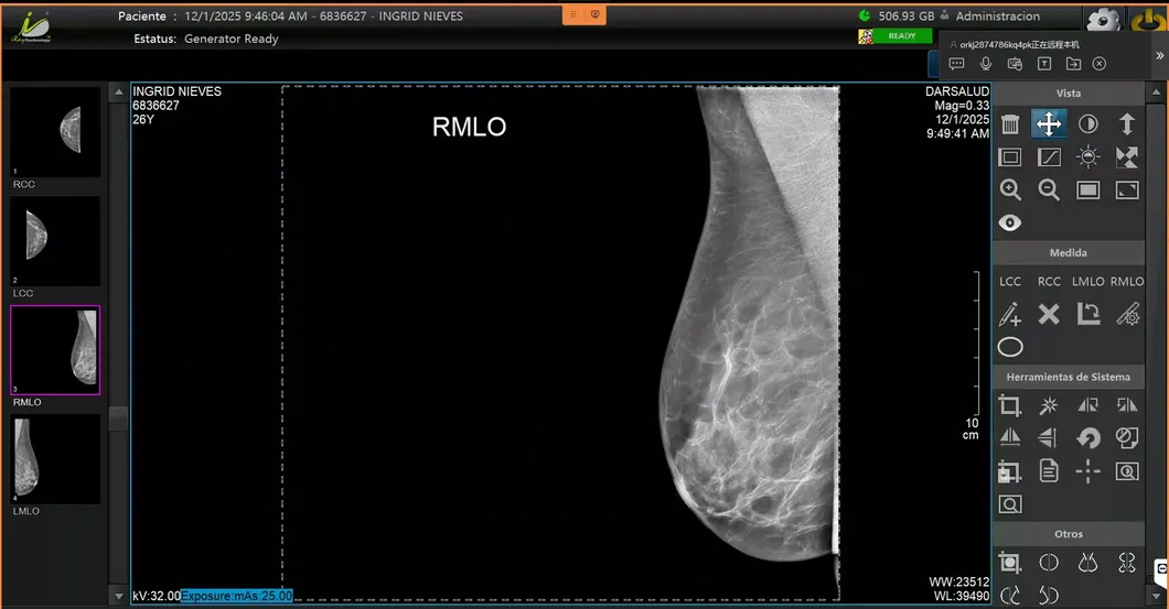 Imagen Mamográfica 6