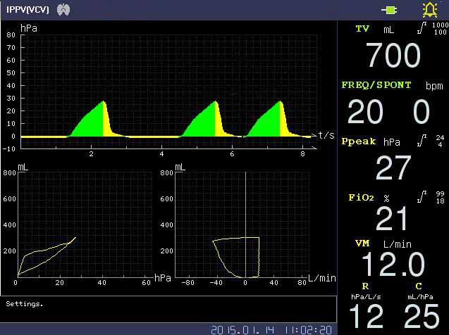 10.4" Mostrar Máquina de Anestesia Móvil Multifuncional Monitor Hospitalario Vaporizador Máquina de Anestesia