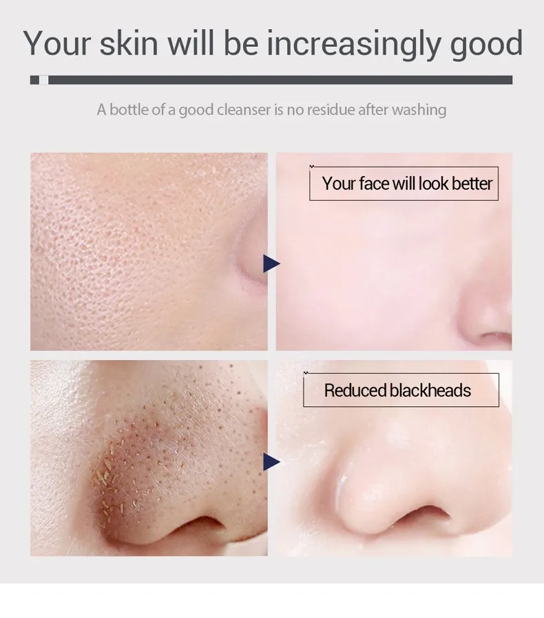 Limpeza Facial 6
