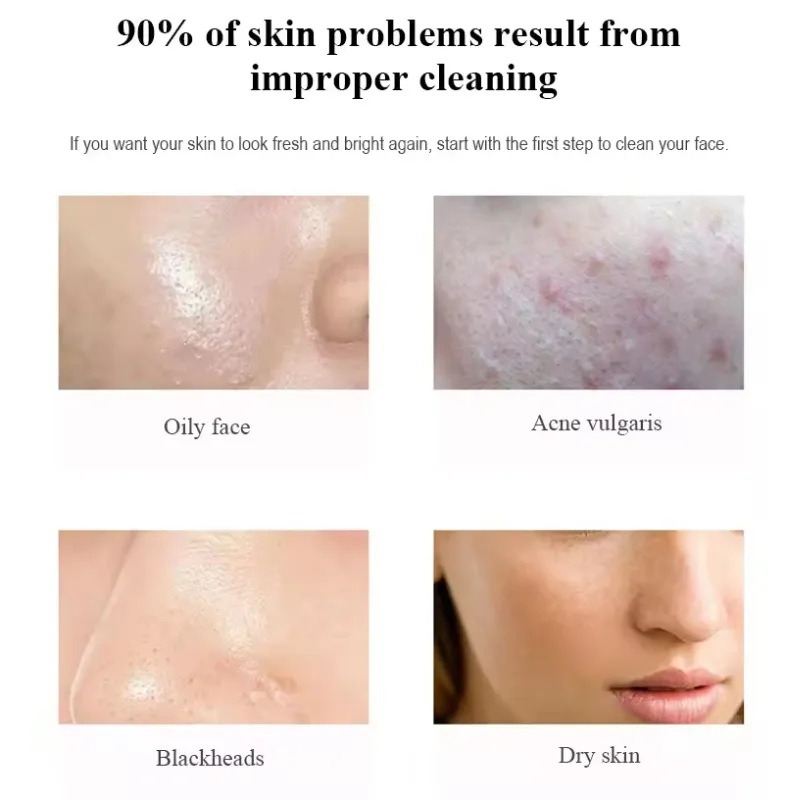 Limpeza Facial 2
