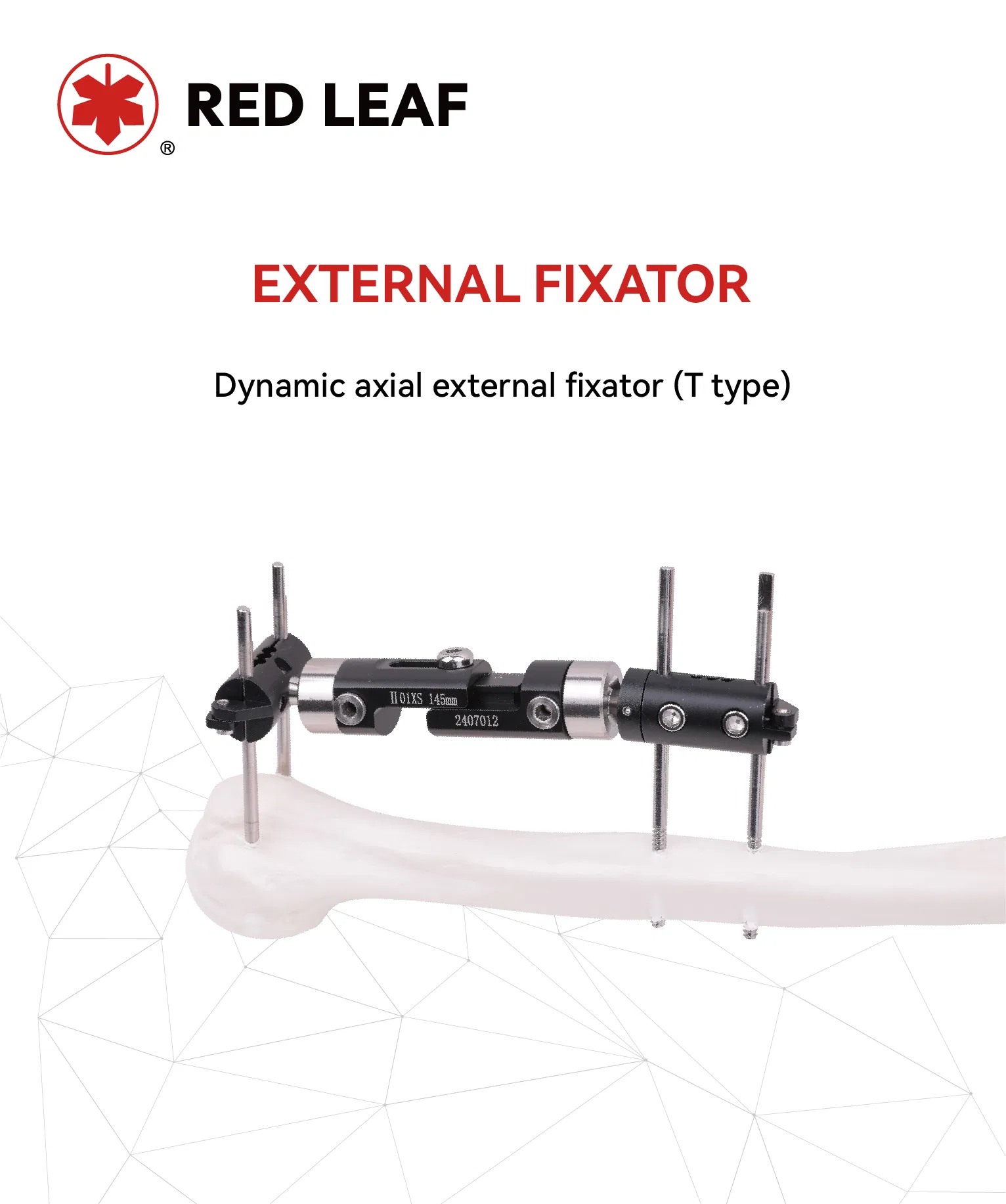 Dynamic Axial Fixator Overview