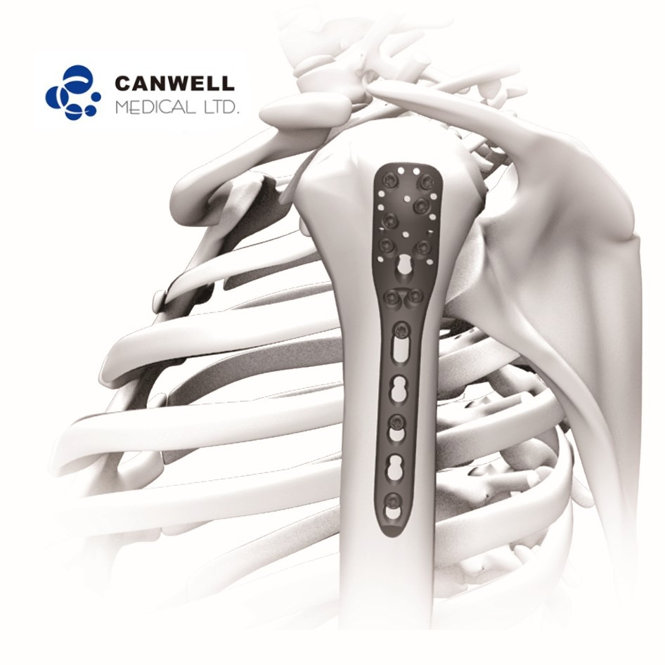 Canwell Humerus Orthopedic Bone Titanium Plate Implant Price Humeral Locking Plate