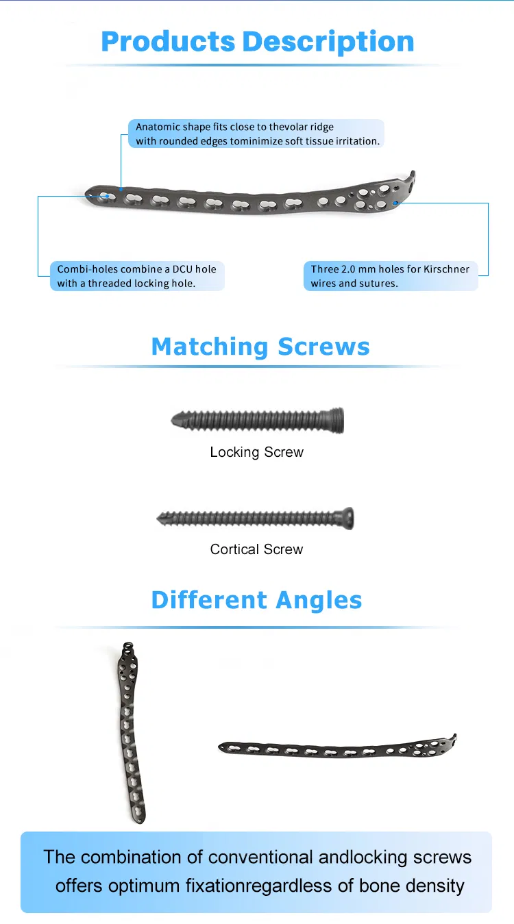 Ulna Olecranon Locking Plates