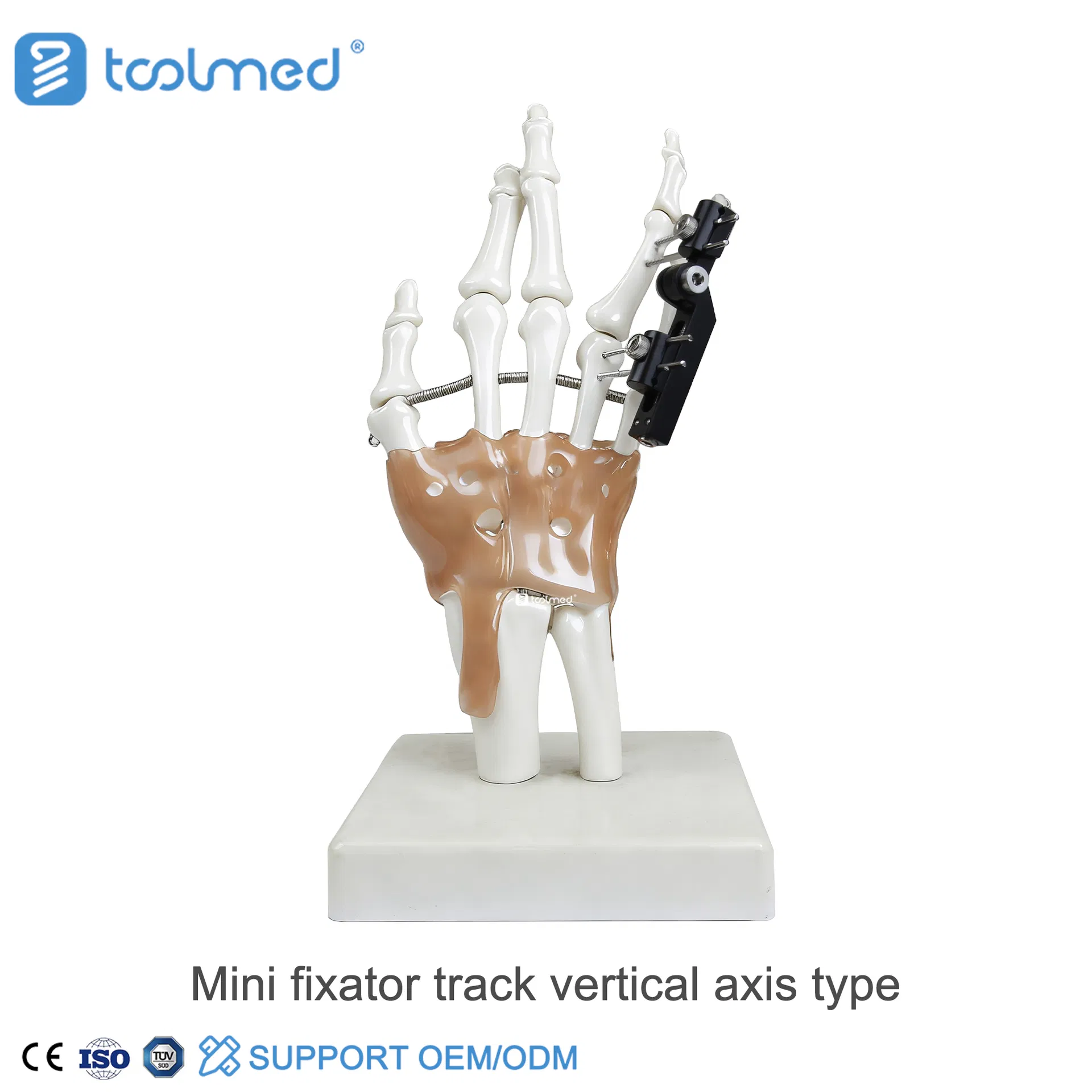 External Fixator View 5