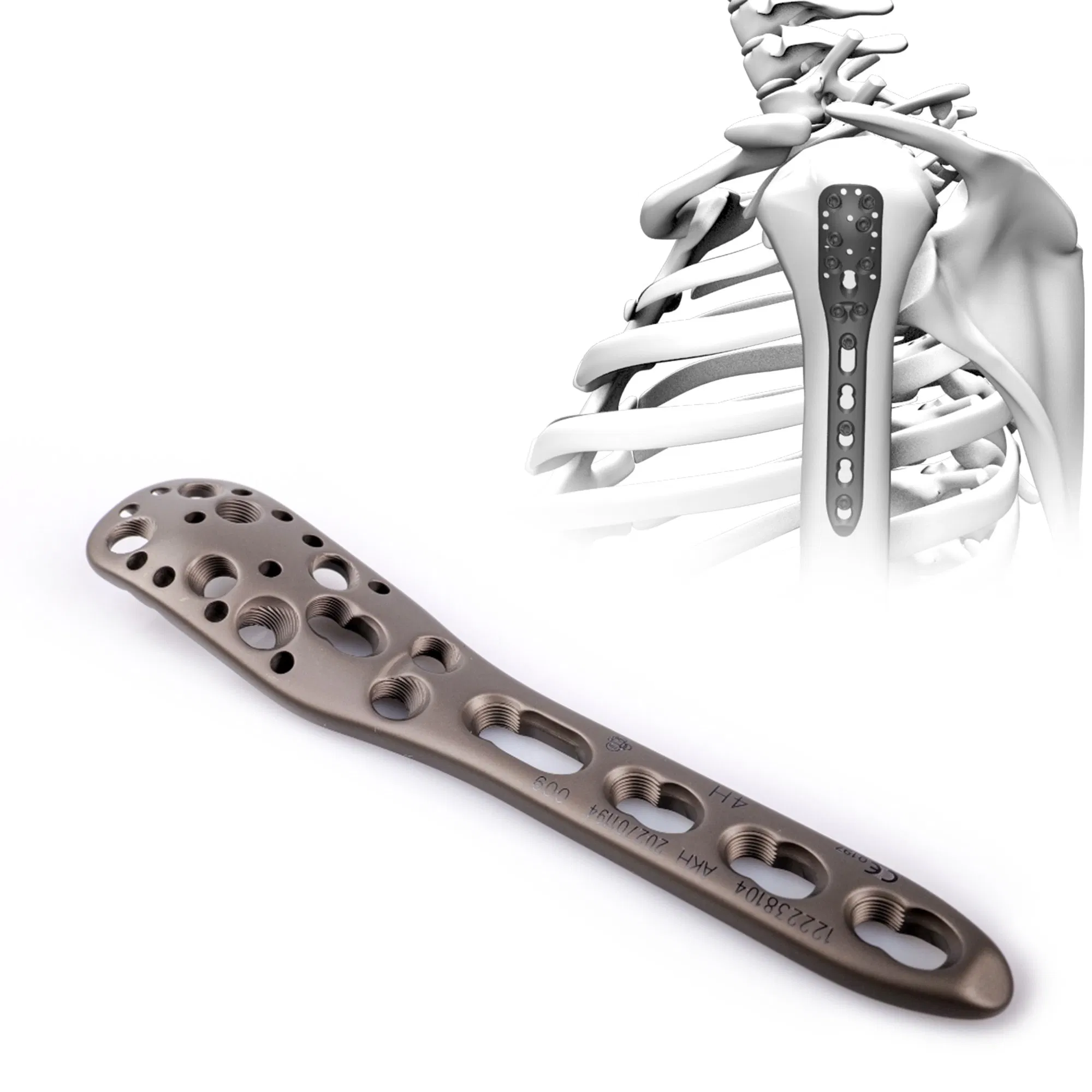 Canwell Humerus Orthopedic Bone Titanium Plate Implant Price Humeral Locking Plate