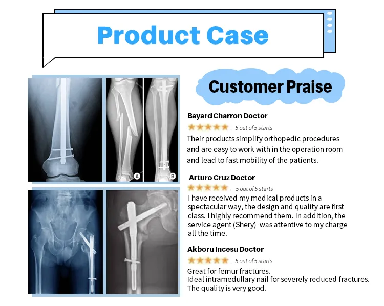 Intramedullary Nail System