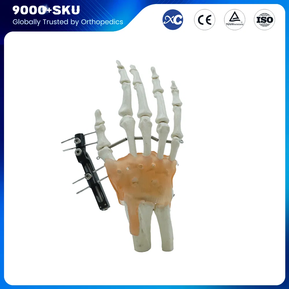 Orthopedic Surgery Trauma Manufacturer Finger External Fixator for Mini Fixator