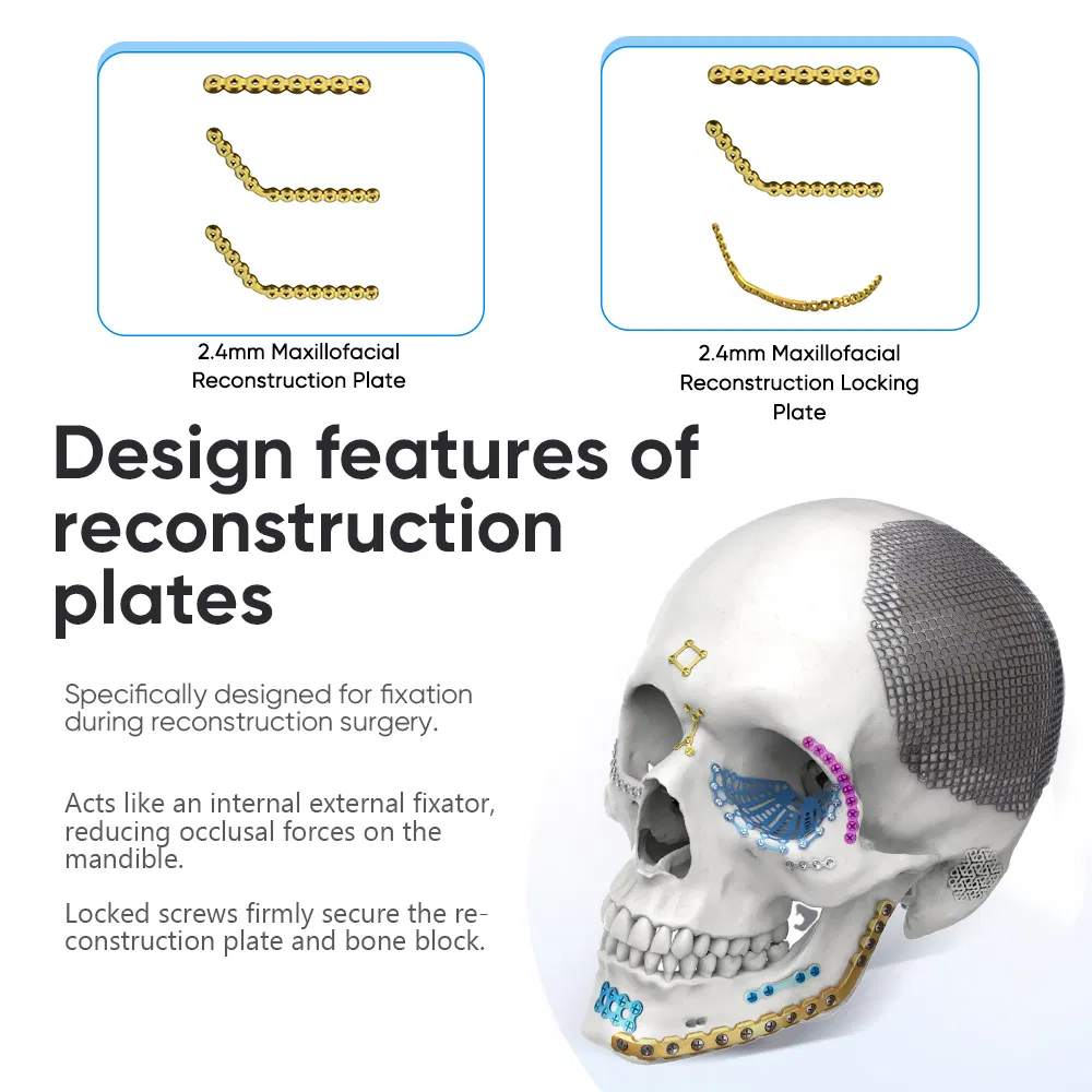 Wholesale Cmf Internal Fixation Surgery Mandible Reconstruction Titanium Maxillofacial Mini Plate Implant