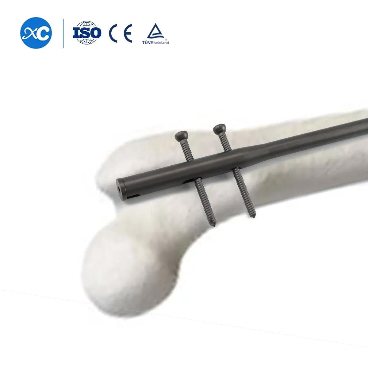 Lockable Intramedullary Nail Titanium Alloy