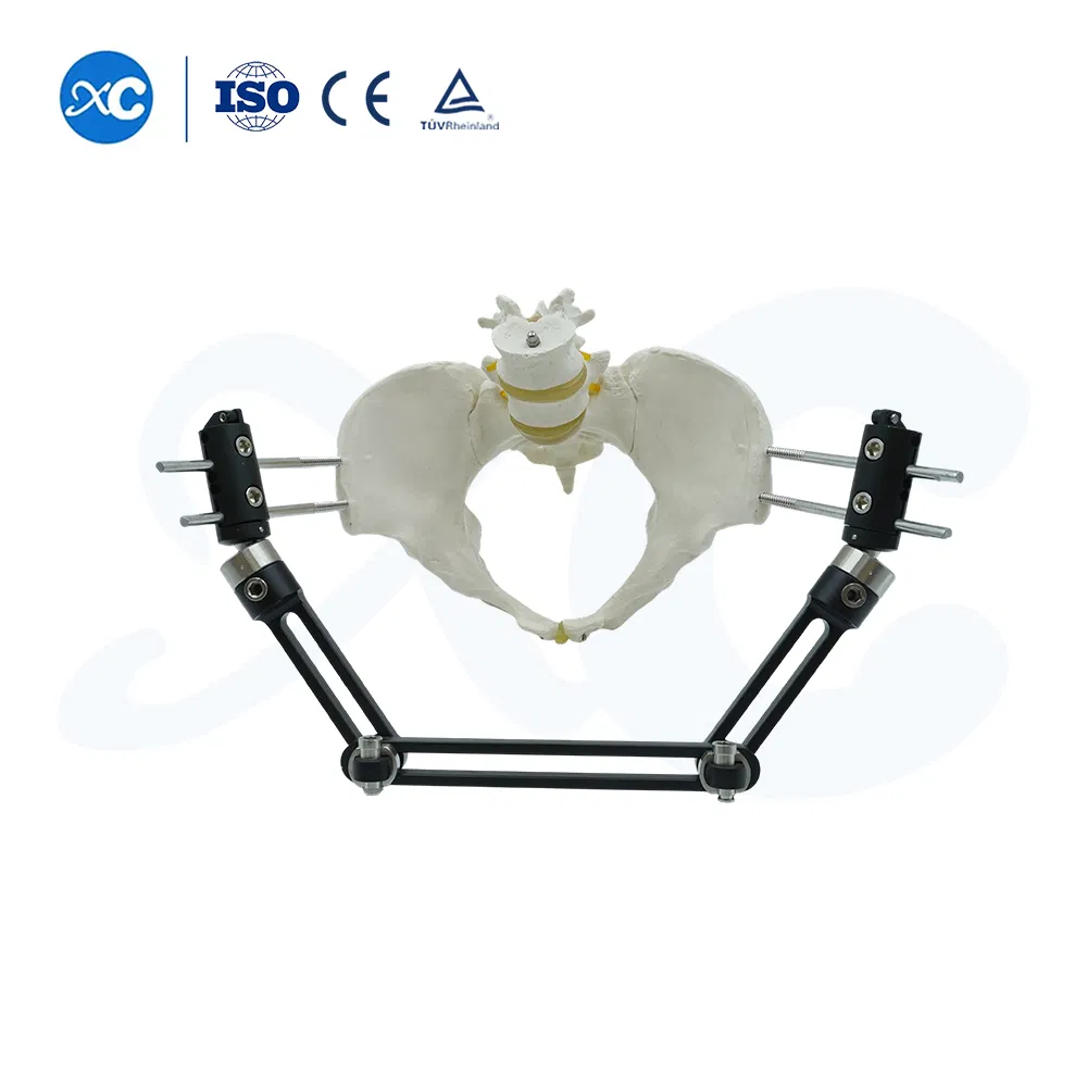 Factory Direct Supply Orthopedic Implant Pin External Fixator - Pelvic &amp; Femoral Fracture Fixation Device Trauma Repair