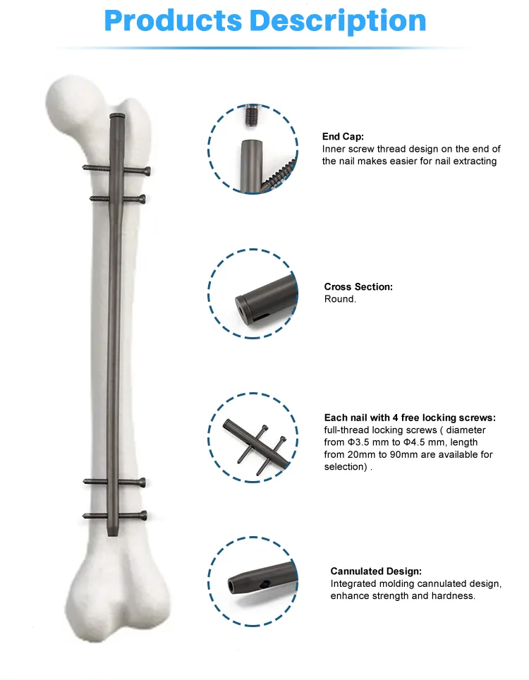 Orthopedic Nail Detail