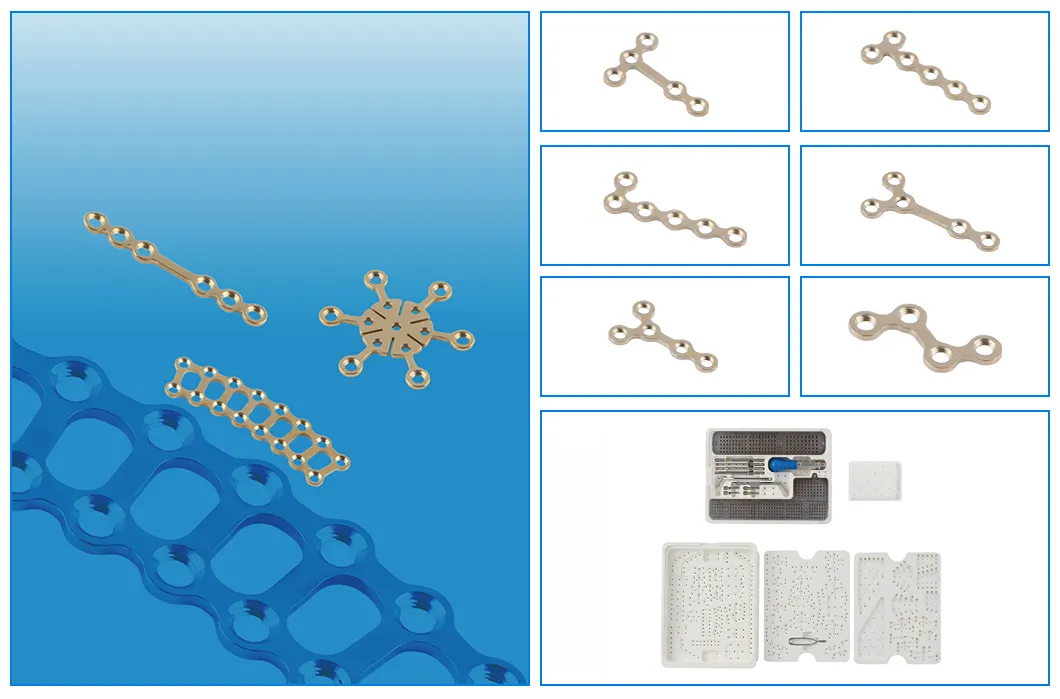 Key Features Illustration