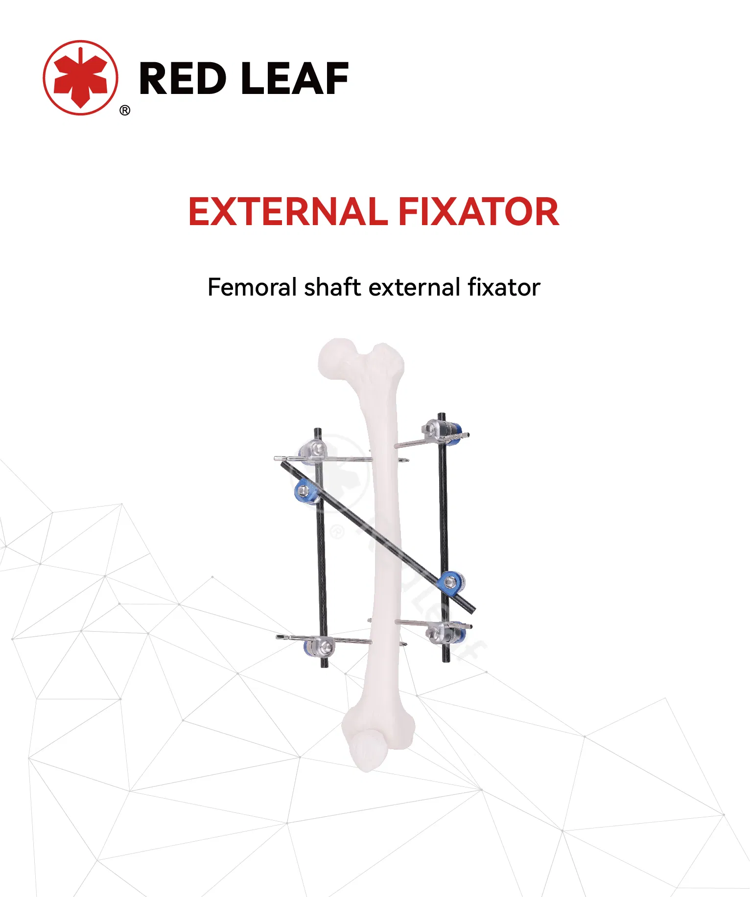 Femoral Shaft Fracture Fixator