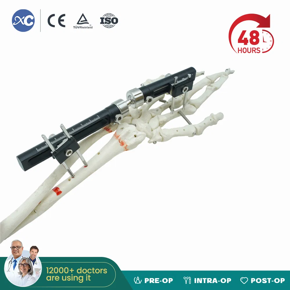 Orthopedic Wrist External Fixator Medical Instrument for Fracture Surgical Fixation