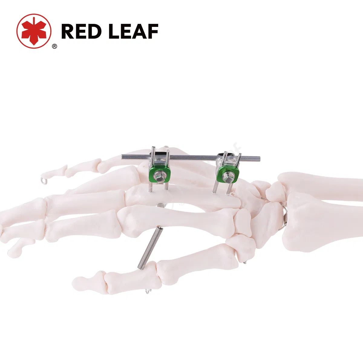 Mini External Fixator Bone Fracture Orthopedic Instrument Combination Palm Fixation