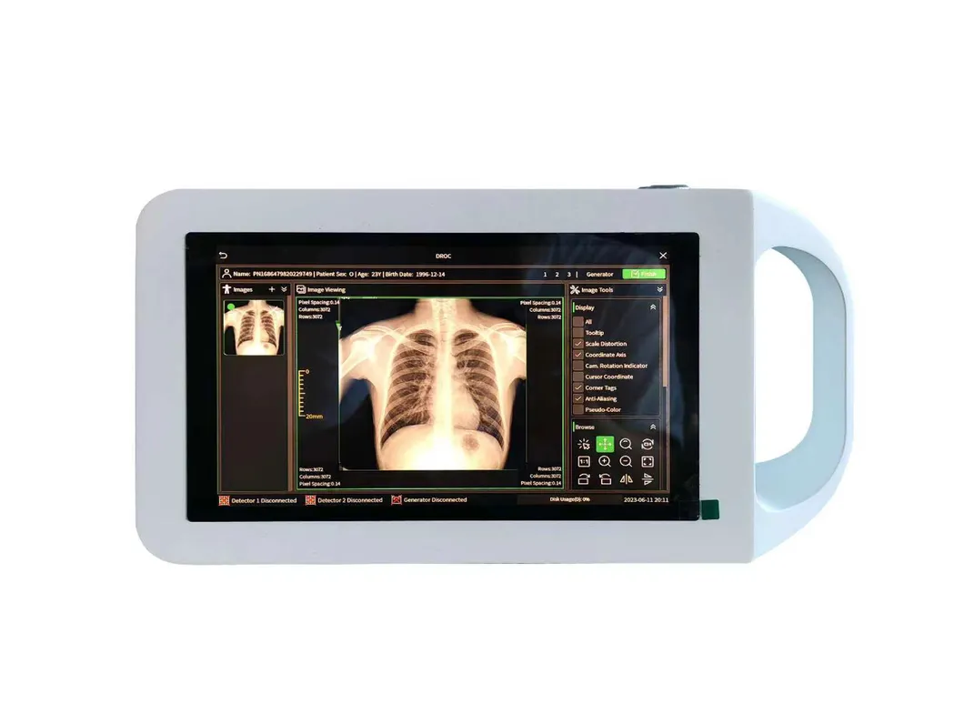 Handheld High-Frequency Medical X-ray Imaging Device
