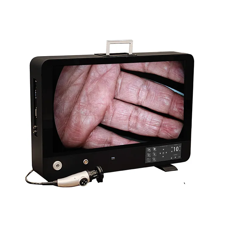 Full HD Endoscopy Camera System