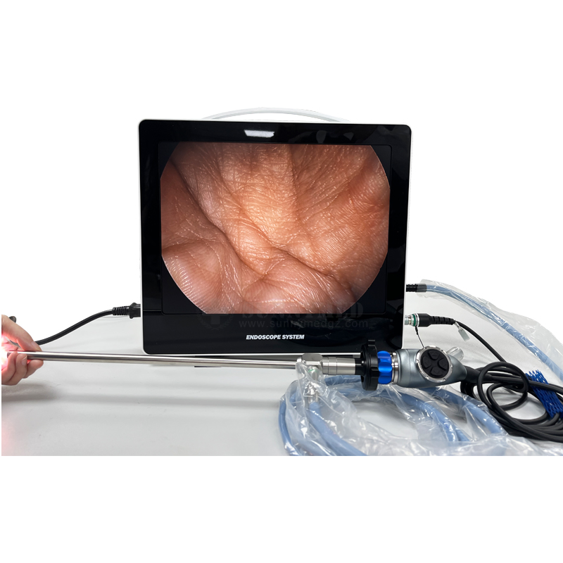 Sy-PS050 Full HD Endoscope Camera System Widely Used Digital Endoscope Full HD Endoscope Camera System