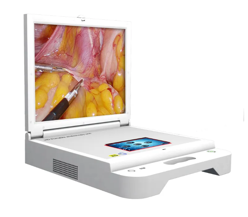 Portable Endoscope System View 2