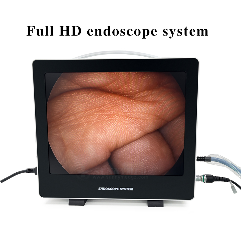 Sy-PS050 Full HD Endoscope Camera System Widely Used Digital Endoscope Full HD Endoscope Camera System
