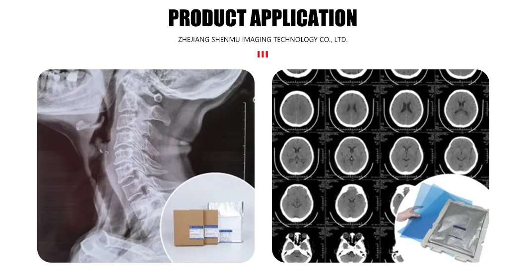 Clinical Application