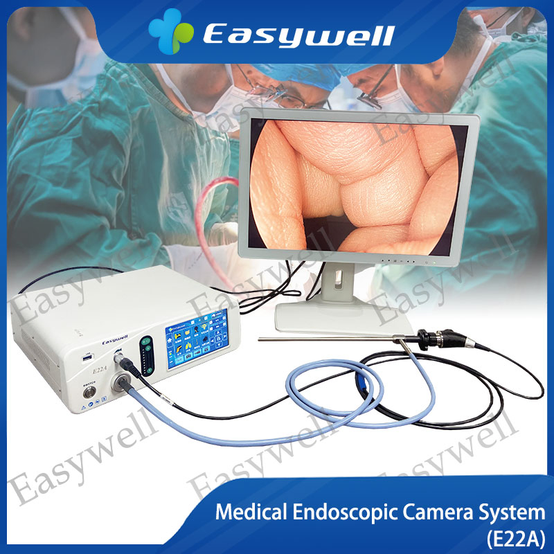 E22A FHD Endoscopic Image System with LED Cold Light Source