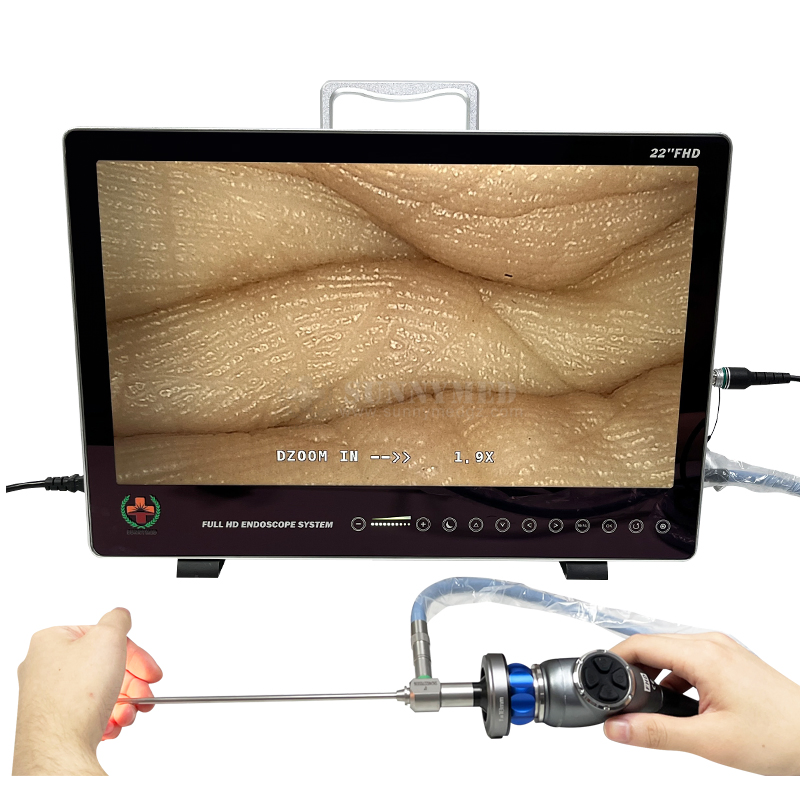 Sy-PS050 Full HD Video Endoscope System for Ent Urology Laparoscopy Endoscopy Integrated LED Light Source