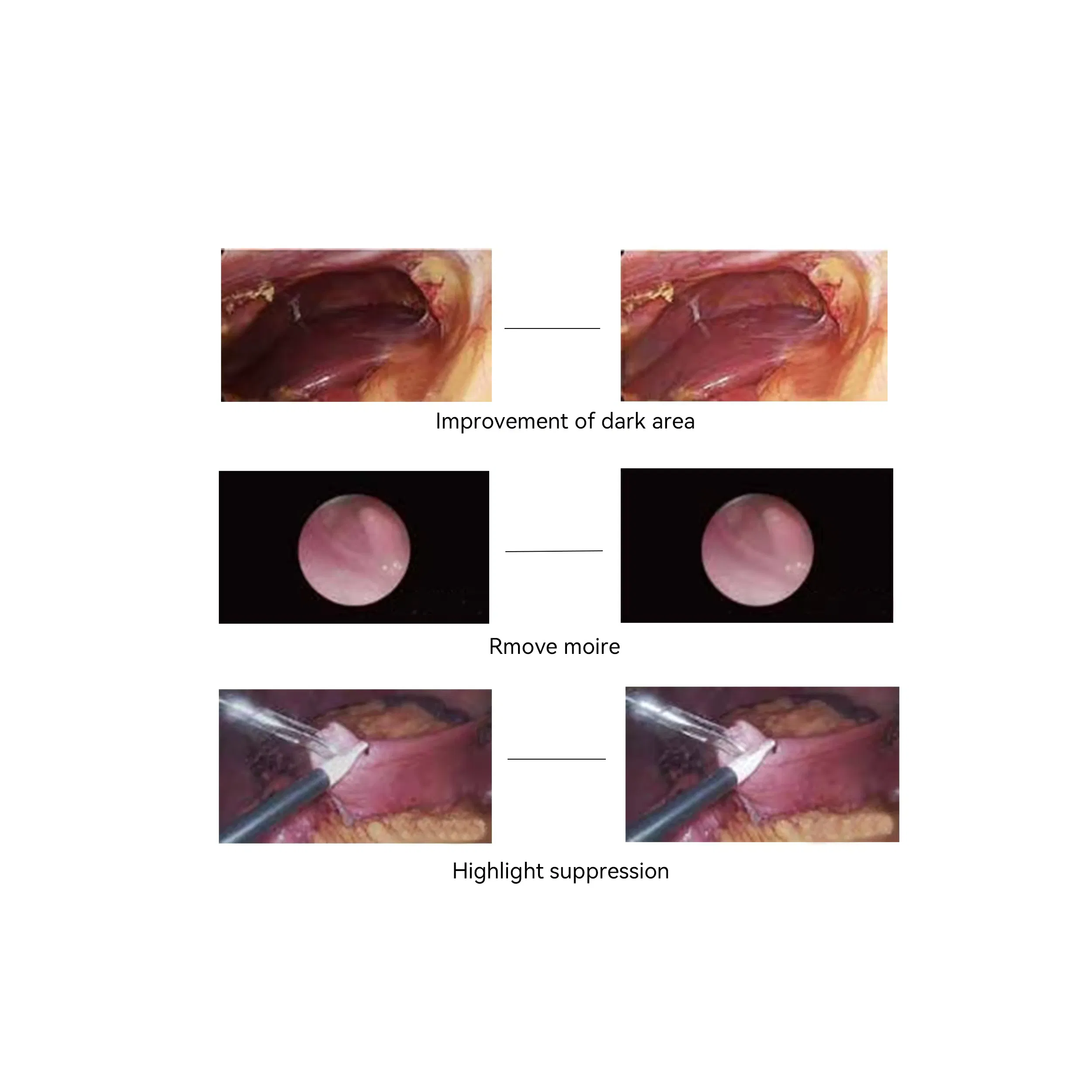 Medical HD 3-Chip Endoscope System Basis of Surgical Instruments with 3CMOS Endoscope Camera