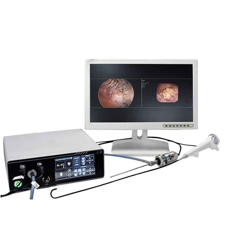 Manufacturer Medical 2 in 1 Integrated Rigid Endoscopy and Flexible Endoscopic System