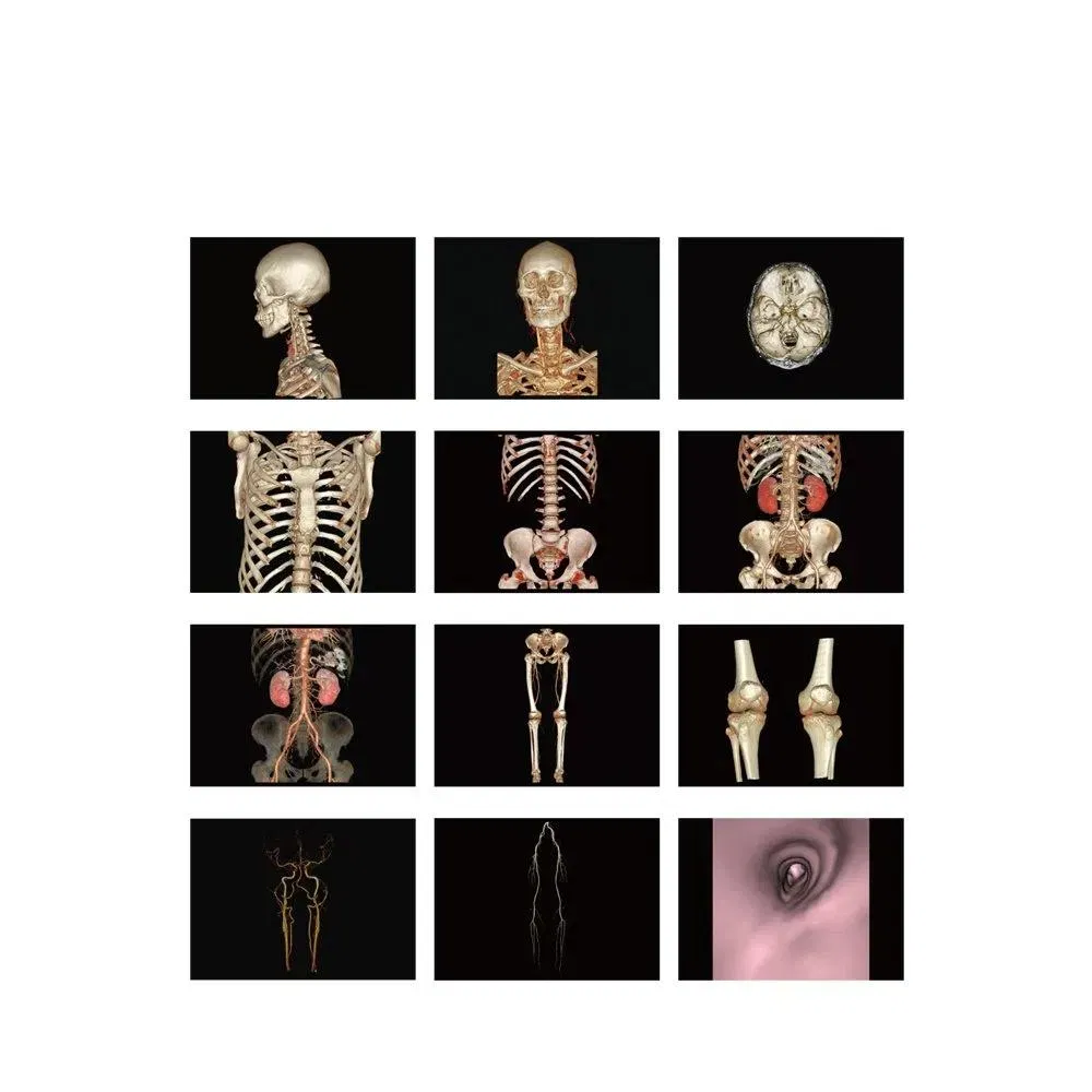 MRI 16 32 64 128 Slice System CT Scan Machine Scanner Mobile Dr for Diagnostic CT Scanner Imaging
