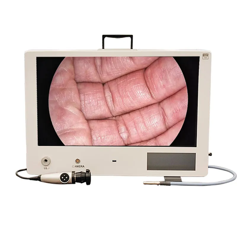 Endoscope Camera System