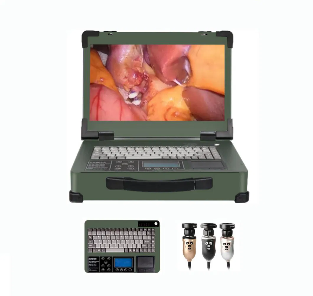 HD Endoscope Camera System 3