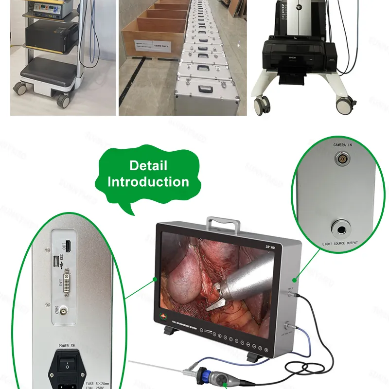 Portable Endoscopy System