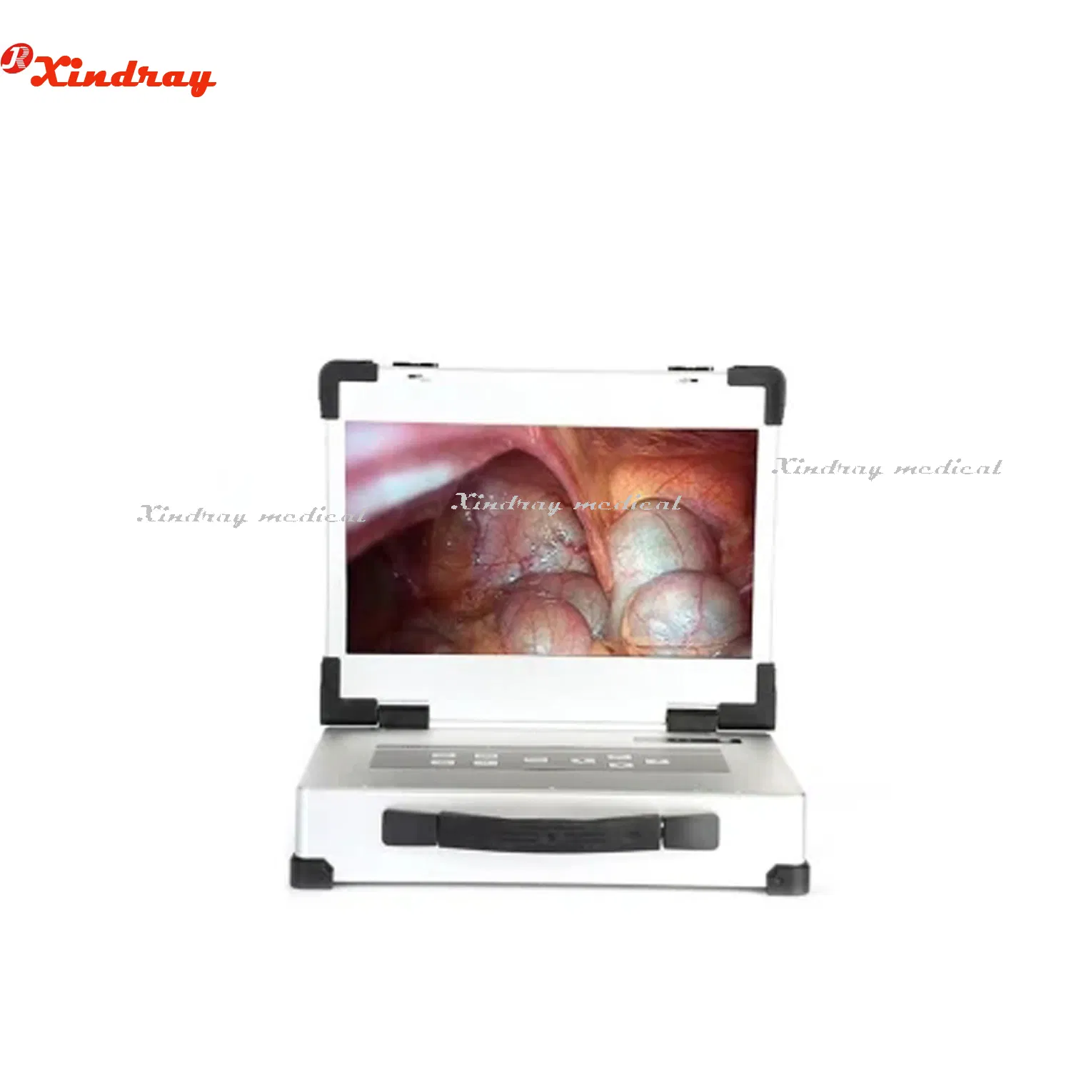 New All-in-One Portable Endoscope Camera System with 17.3 Inches Monitor