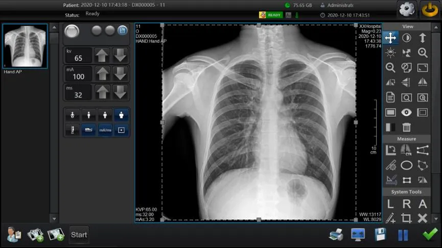 Digital Radiography System View 2