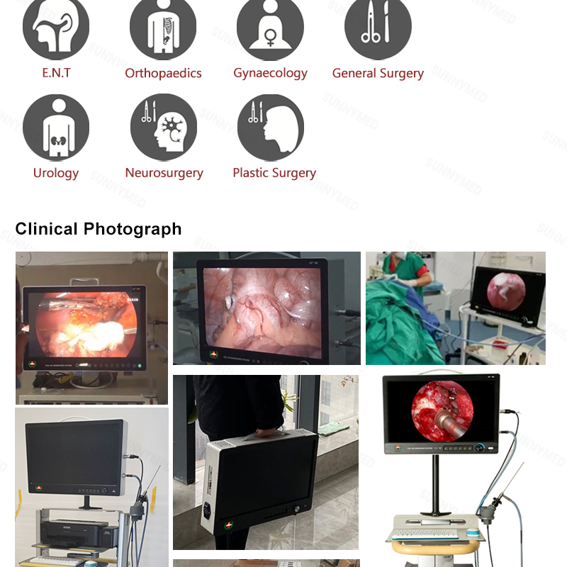 Sy-PS050 All in One 4K HD Video Medical Endoscope Camera System for Spine Laparoscopy Arthroscopy
