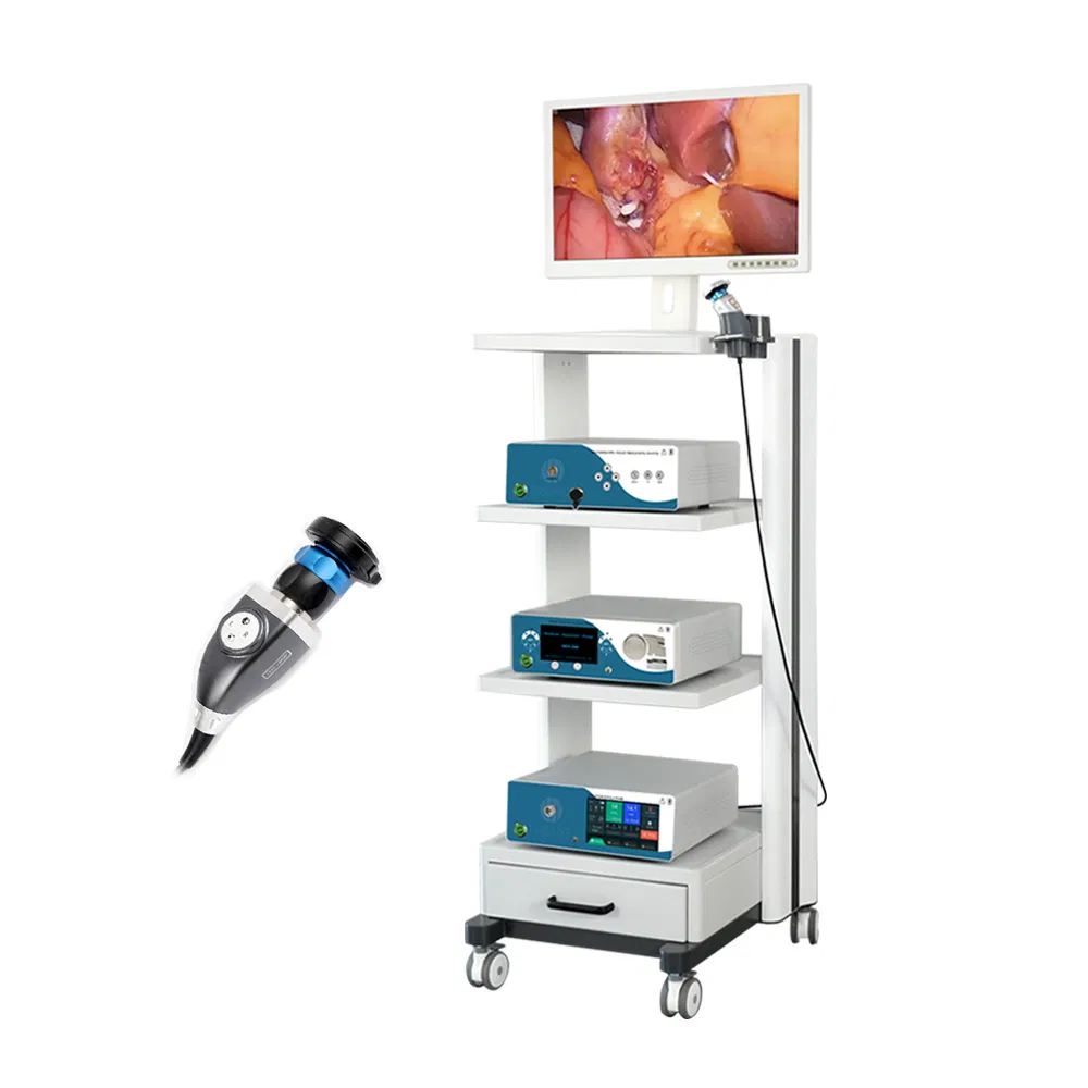 High Quality Light Cold Source Camera Laparoscope Ent HD Rigid Endoscope System