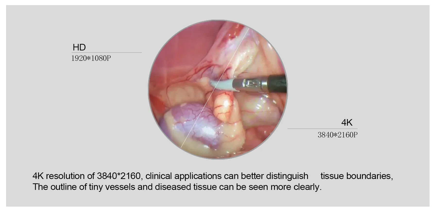 4K UHD Fluorescence USB Record Medical Endoscope System for Arthroscopy