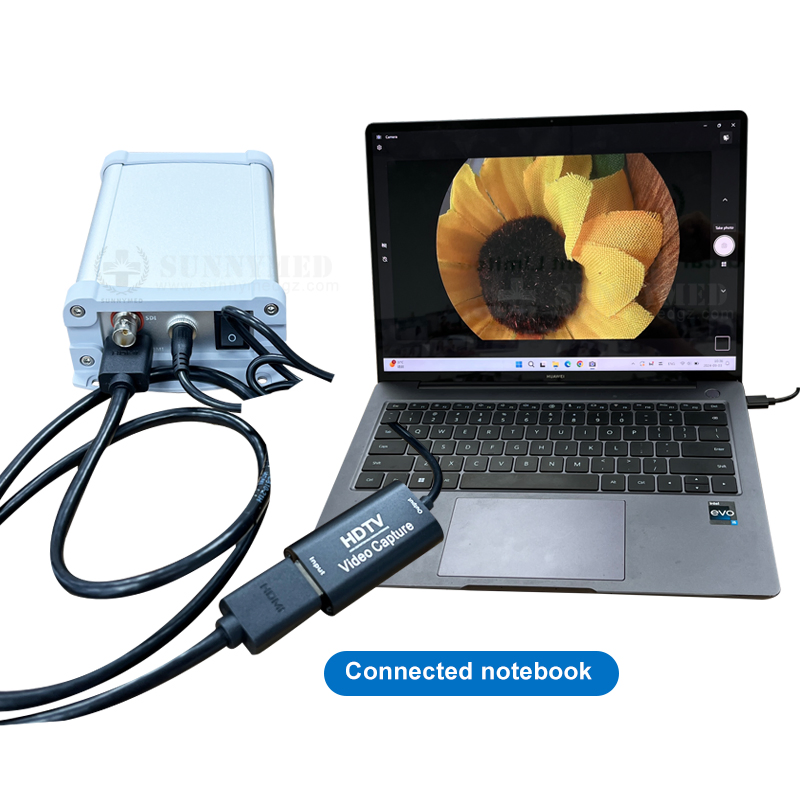Sy-P031HD5 Portable 1080P Full HD USB Endoscope Camera System for Rigid/Flexible Endoscope Ent Surgery