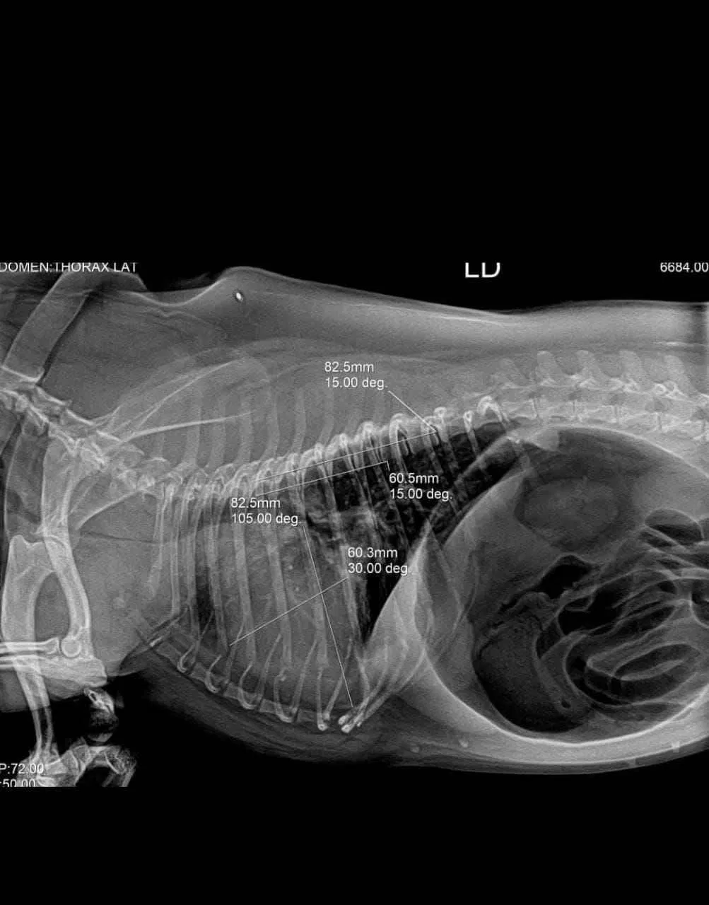 High-Quality Portable Xray System - Ideal Medical Imaging for Clinics and Hospitals