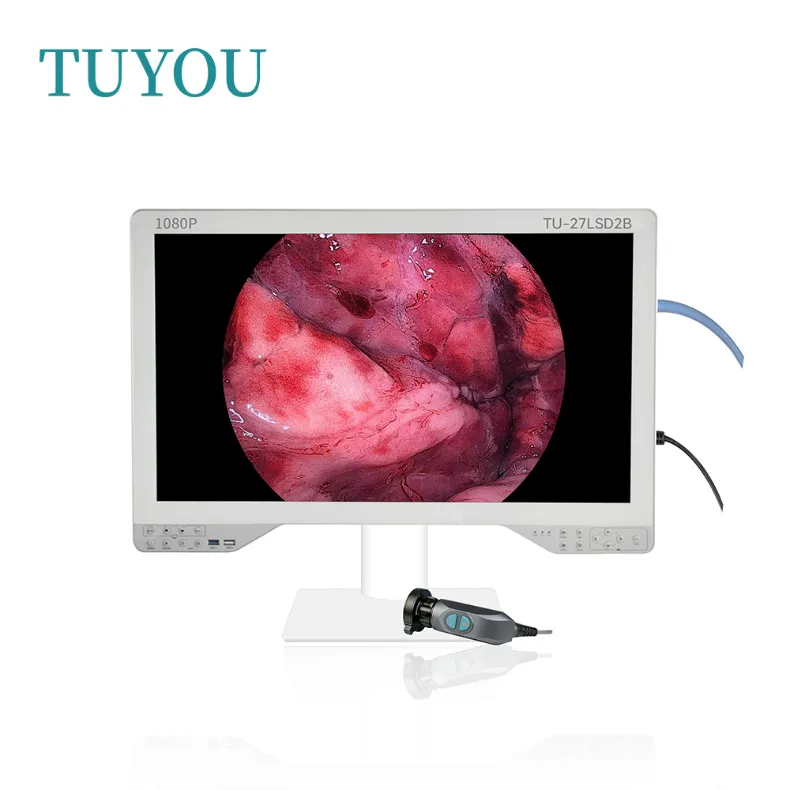 Endoscope System Overview