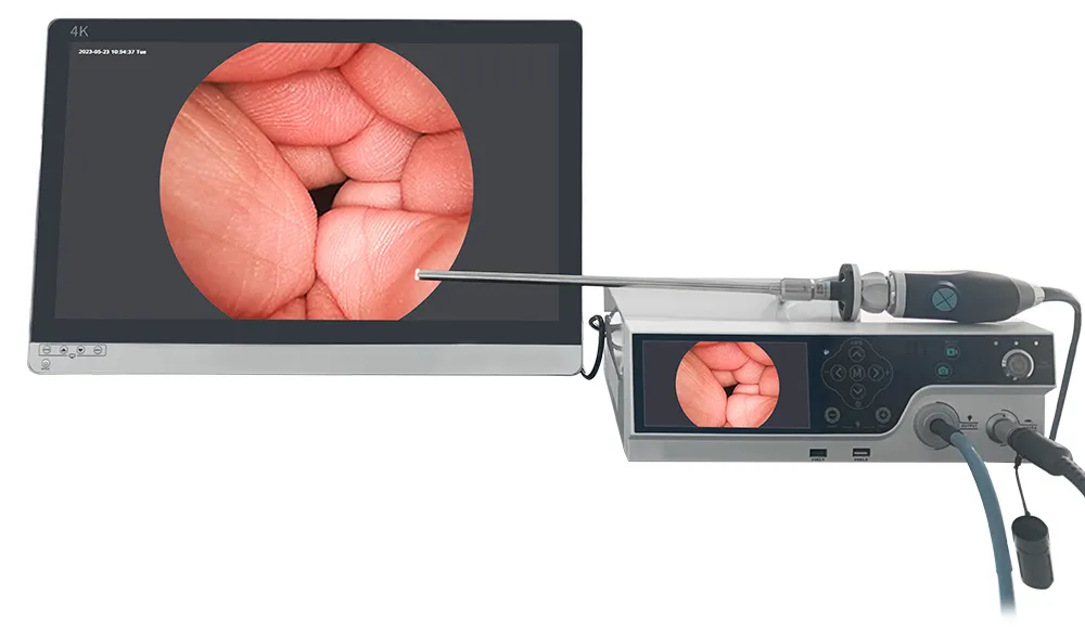 Endoscopy Camera System Main