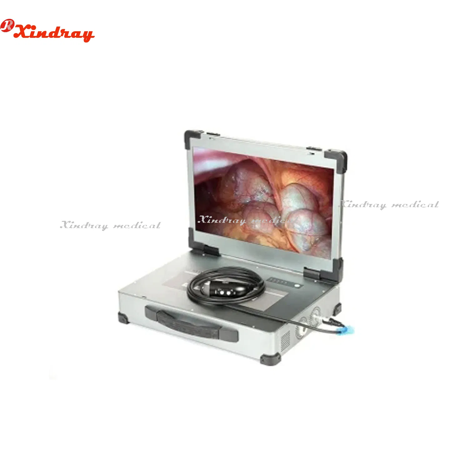 New All-in-One Portable Endoscope Camera System with 17.3 Inches Monitor