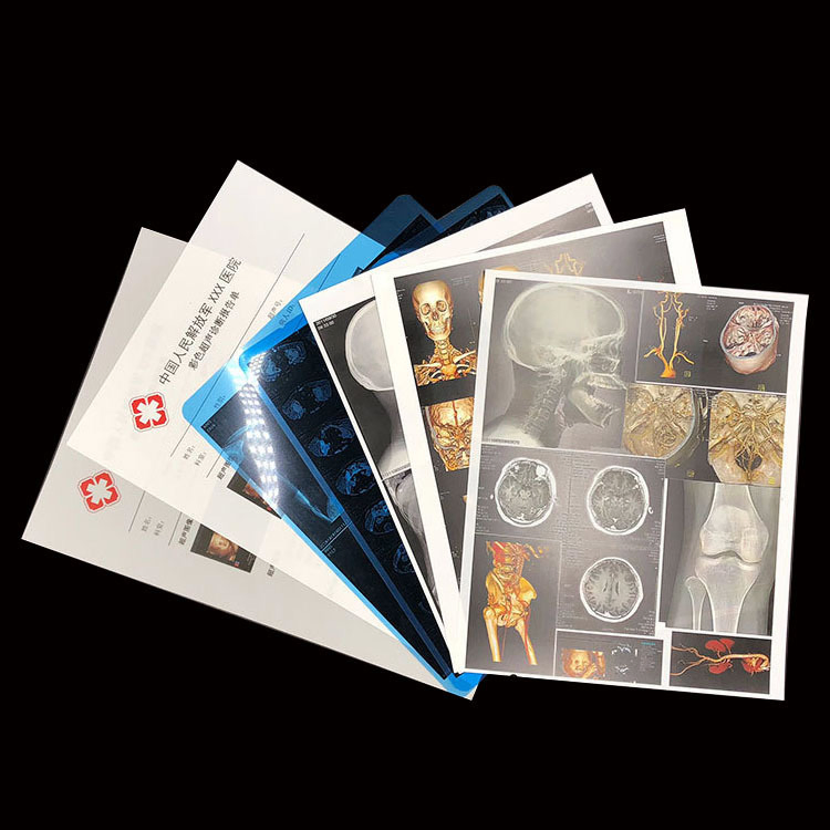 Modern Medical Dry Imaging High Resolution Clear Image Cost-Effective Film